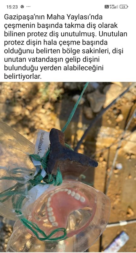 Hüseyin Karadeniz Takma Diş