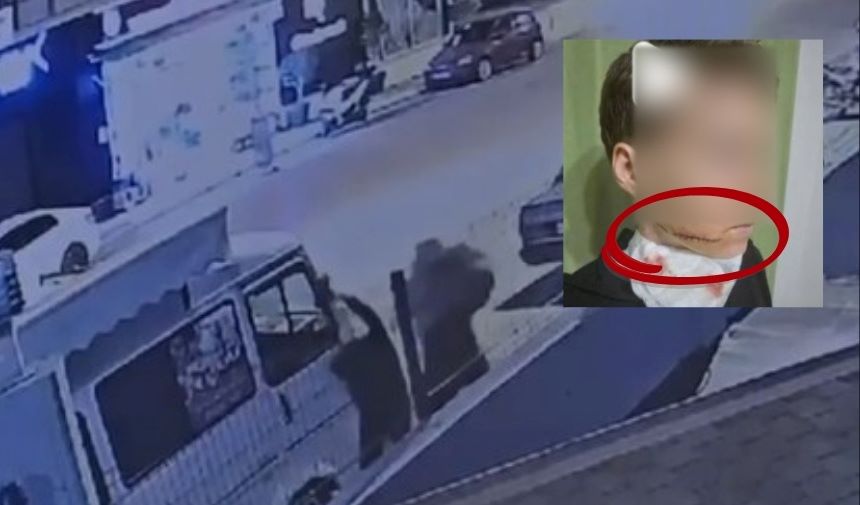 Alanya'da Sokak Saldırısı Ukraynalı Kadının Yüzünü Kesti! (1)