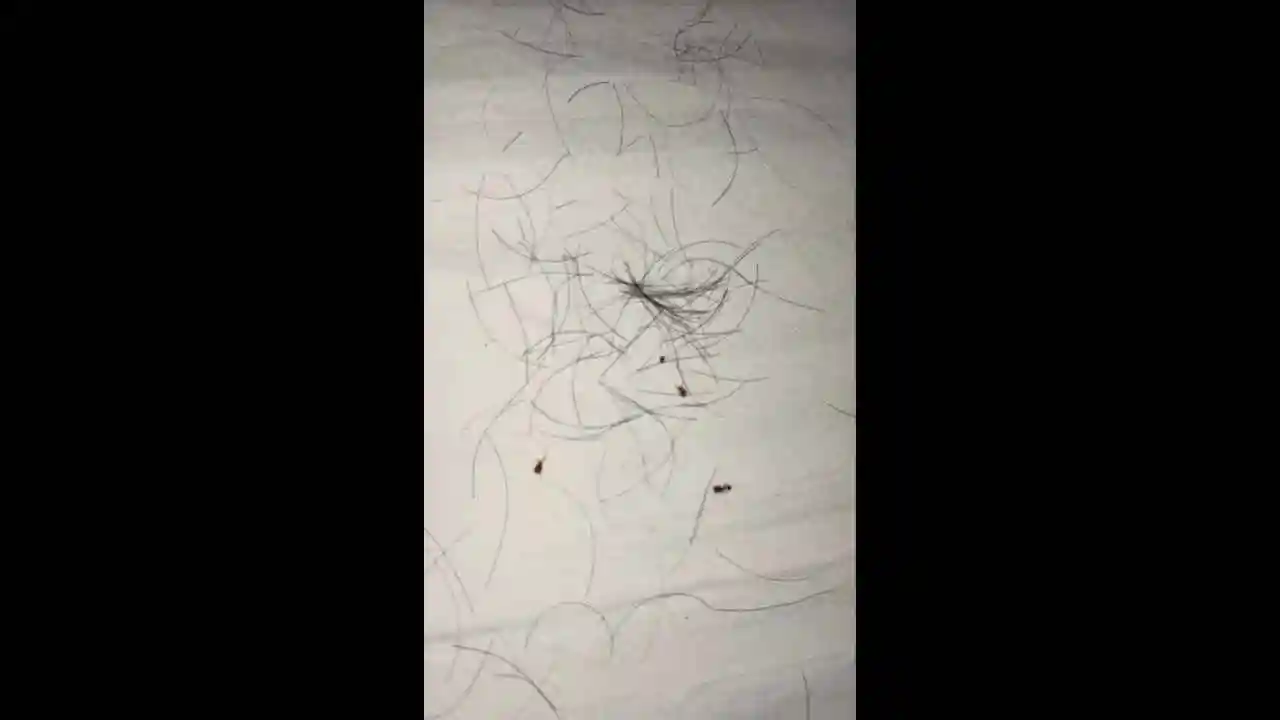 Antalya'da Geceliği 20 Bin Tl Olan Otelde Böcek Iddiası Gündem Oldu (4)Körfezzxç