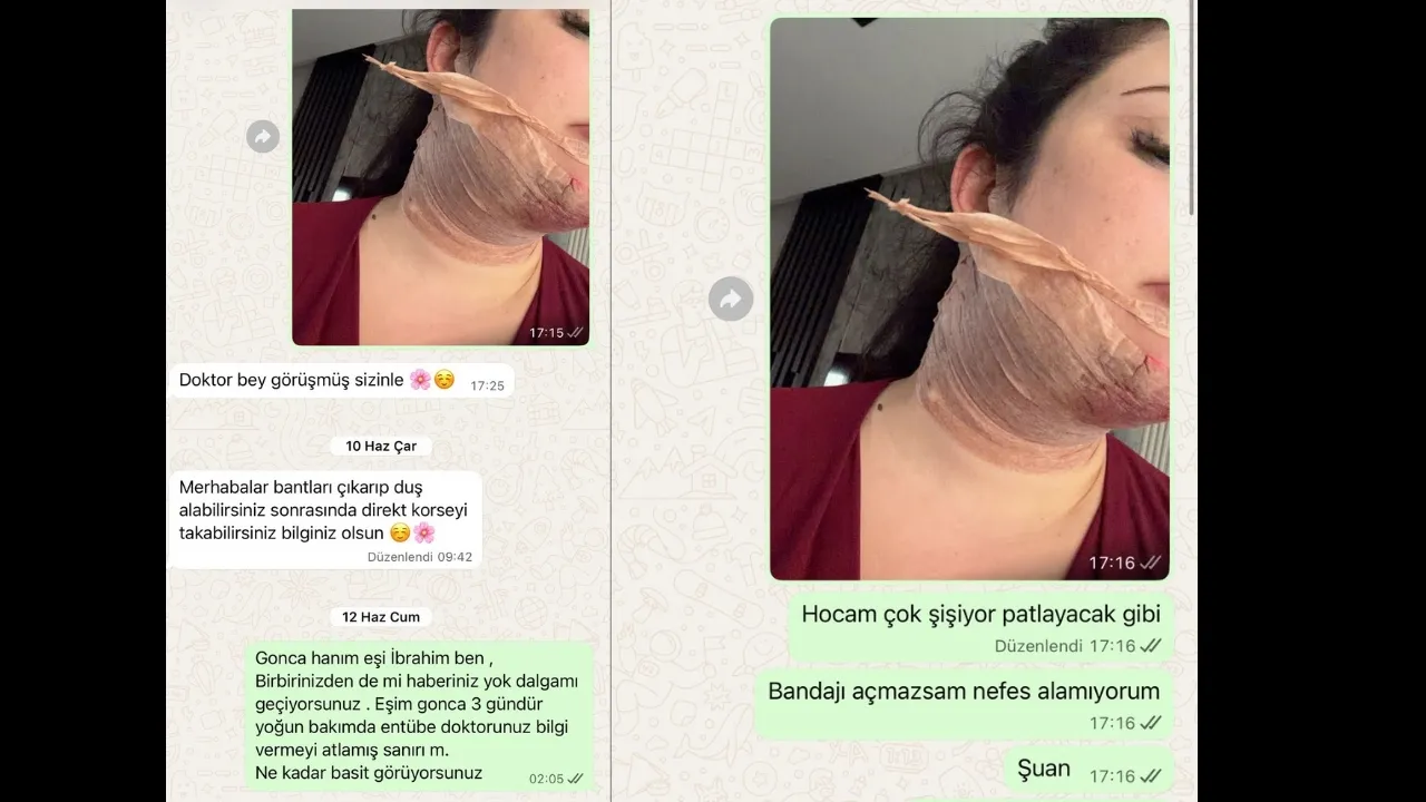 Antalya’da Estetik Işlem Kabusa Döndü! 5 Milyon Tl’lik Dava Açtı (2)Körfezzxç
