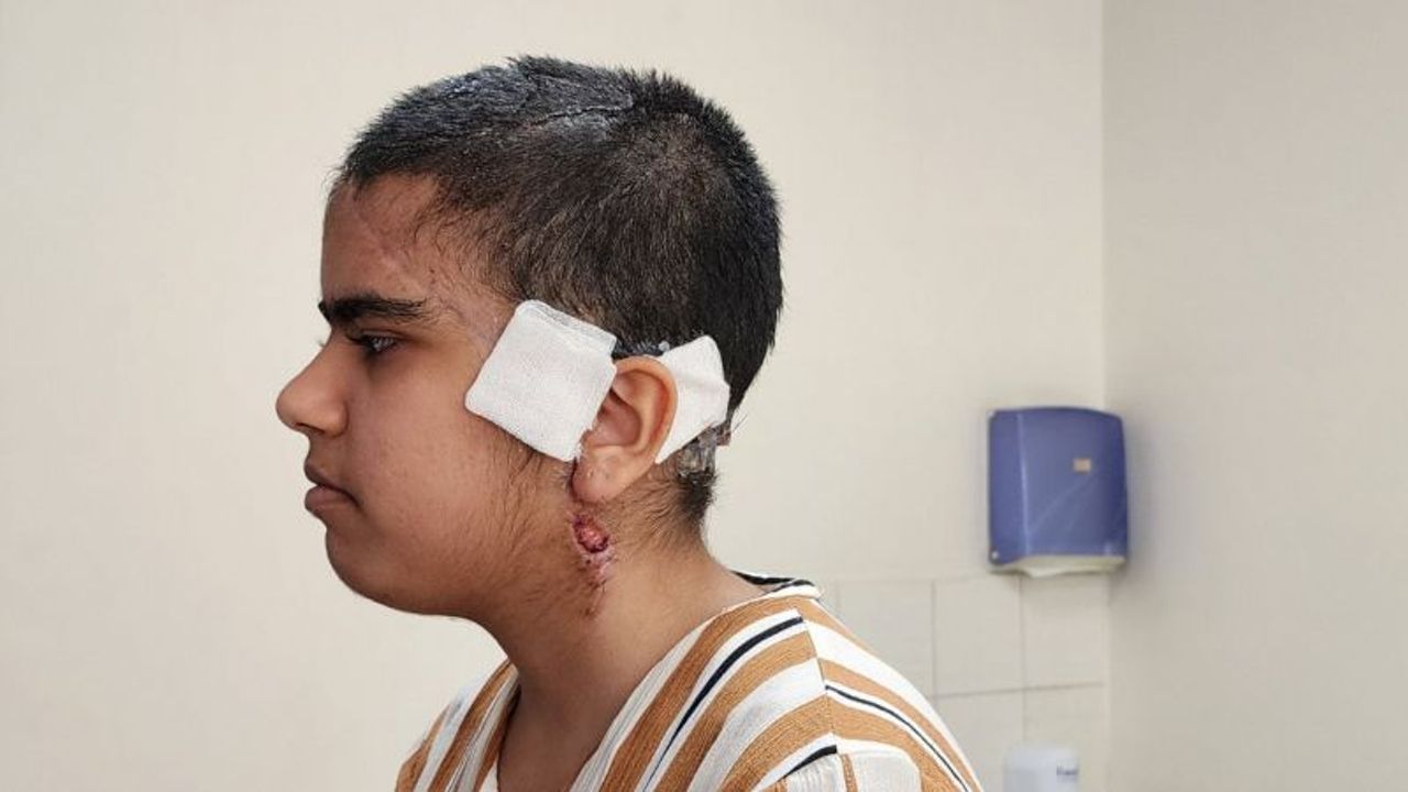 15 yaşındaki Lara Ali Turki Aljanabad'ın saçı tekerlere dolanınca başından sıyrıldı