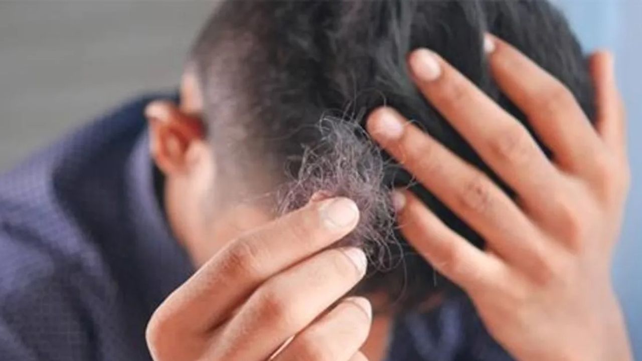 Antalya'da yetkisiz saç ekimine jandarma engeli