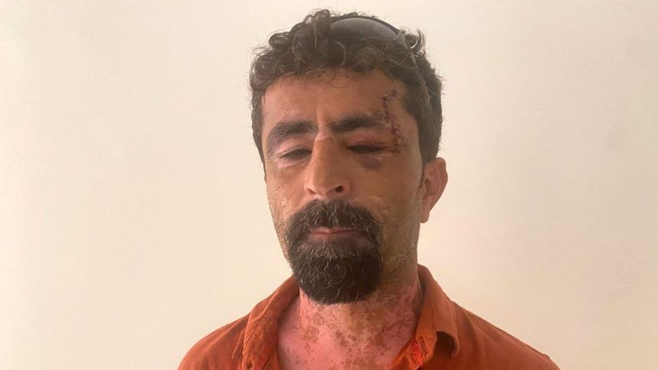 Antalya'da damat dehşeti! Kayınpederinin kafasına 13 dikiş atıldı