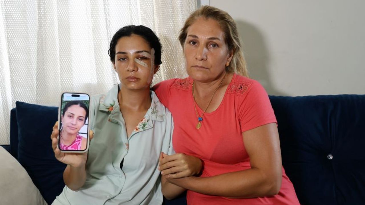 Adana'da eski eşinden şiddet gören kadın: "Ben yaşarken kurtulayım, öldükten sonra değil"