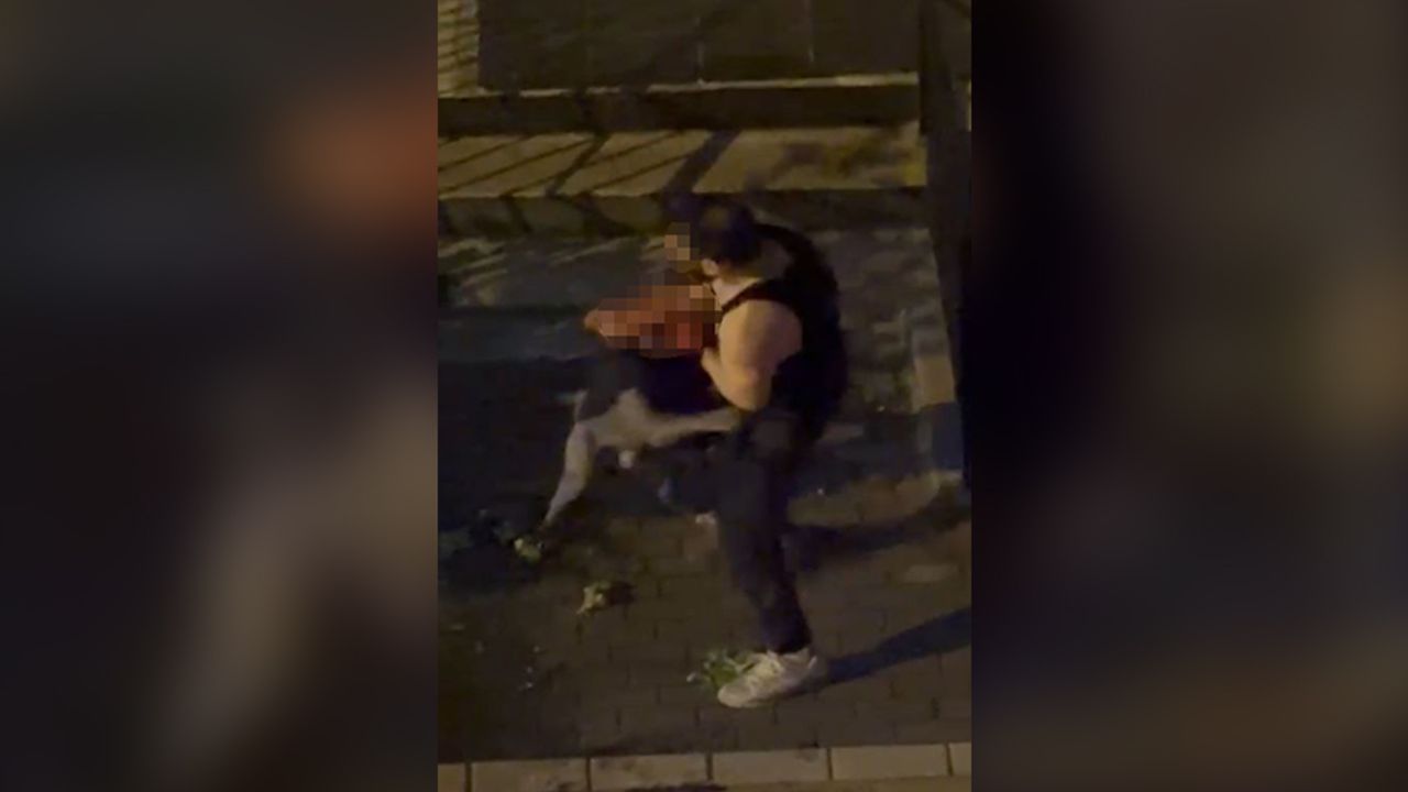 İstanbul’da pitbull dehşeti! Kolunu zar zor kurtuldu