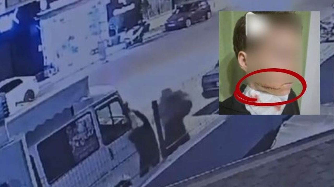 Alanya'da sokak saldırısı: Ukraynalı kadının yüzünü kesti!