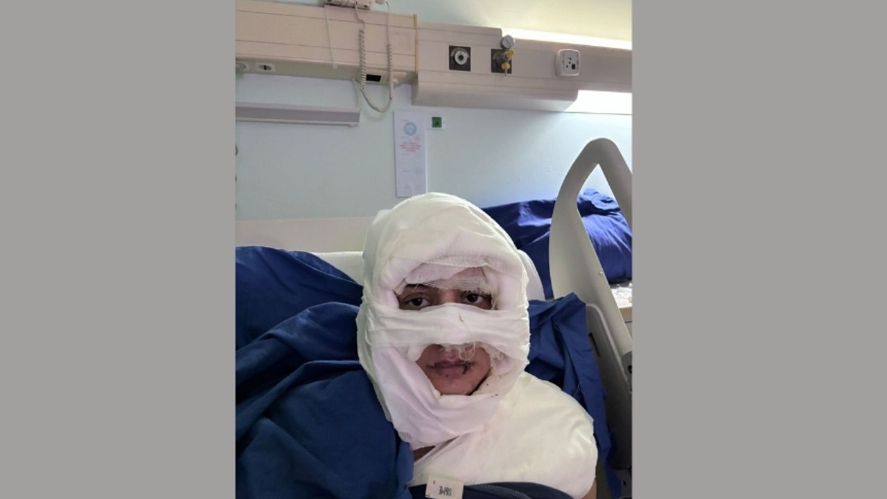 İstanbul'da kadın kadına dehşet! Yanıcı madde dökerek ateşe verdi