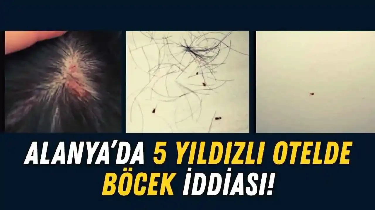 Alanya'da geceliği 20 bin TL olan otelde böcek iddiası gündem oldu