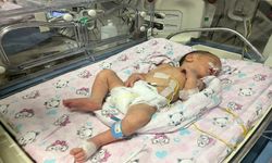 Doktorlar "imkansız" demişti! Annesi kazada ölen bebek sezaryenle yaşama tutundu!