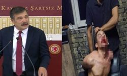 TİP Genel Başkanı Antalya'da işkence gören genç için konuştu: "Sonuna kadar yanındayız"
