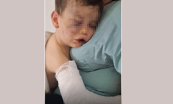 Denizli'de 2 yaşındaki bebek hastanelik oldu!