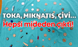 Toka, mıknatıs, çivi… Daha neler neler hepsi mideden çıktı!