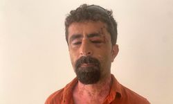 Antalya'da damat dehşeti! Kayınpederinin kafasına 13 dikiş atıldı