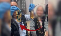 Dilencinin üstünden çıkan altın miktarı dudak uçuklattı