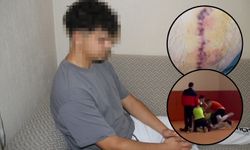 Mendil kapmaca oyunu kanlı bitti: 16 yaşındaki lise öğrencisi 5 yerinden bıçakladı