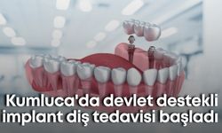 Kumluca'da devlet destekli implant diş tedavisi başladı