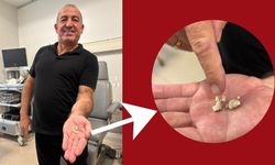 Soğuk algınlığı diye gitti, boynundan taş çıktı