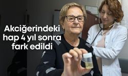Akciğerindeki hap 4 yıl sonra fark edildi