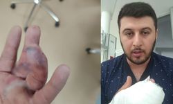 Antalya'da döner bıçaklı saldırıya kuryelerden konvoylu tepki