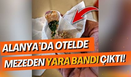 Alanya’da otelde mezeden yara bandı çıktı!