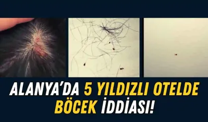Alanya'da geceliği 20 bin TL olan otelde böcek iddiası!