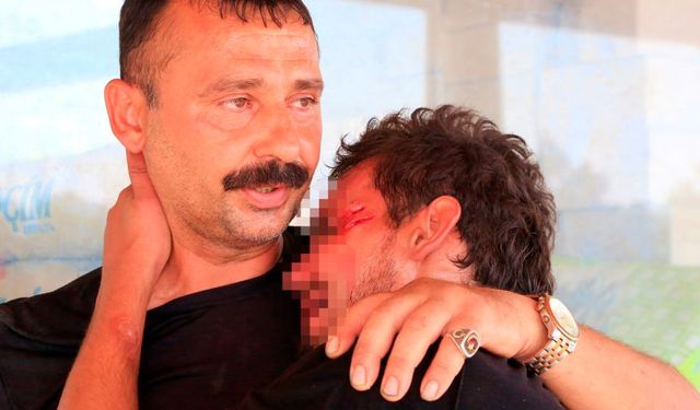 Antalya’da arkadaşının köpeğinin saldırılasına uğradı! Yüzünden yaralanan genç ortalığı birbirine kattı