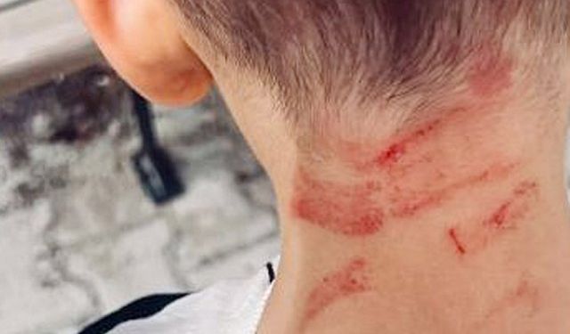 Burdur'da rehabilitasyon merkezinde çirkin olay! 5 yaşındaki çocuk...