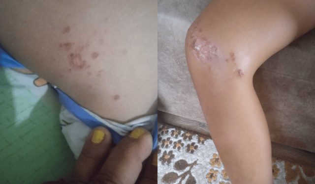 Gazipaşa'da denize giren çocuk enfeksiyondan hastanelik oldu!