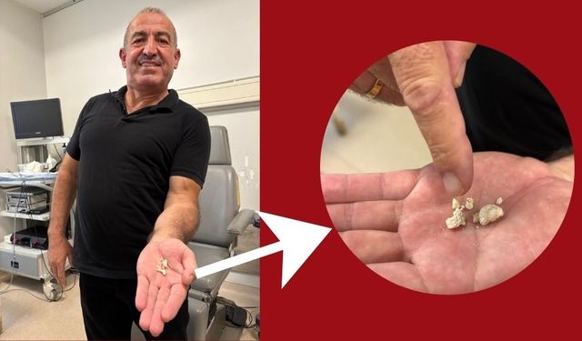 Soğuk algınlığı diye gitti, boynundan taş çıktı