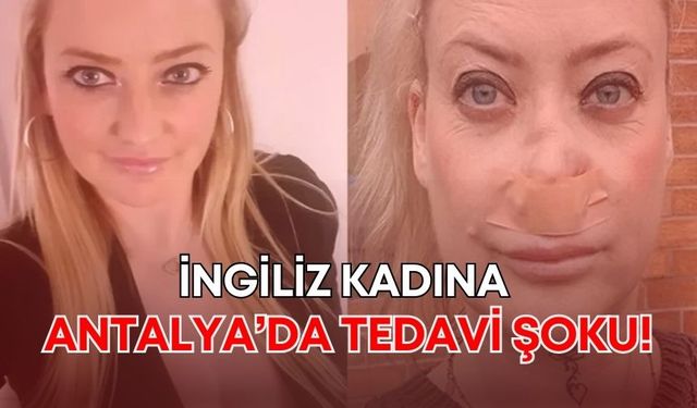 İngiliz kadına tedavi şoku: Antalya'da diş implantı yaptırdı, burnundan nefes alamıyor!