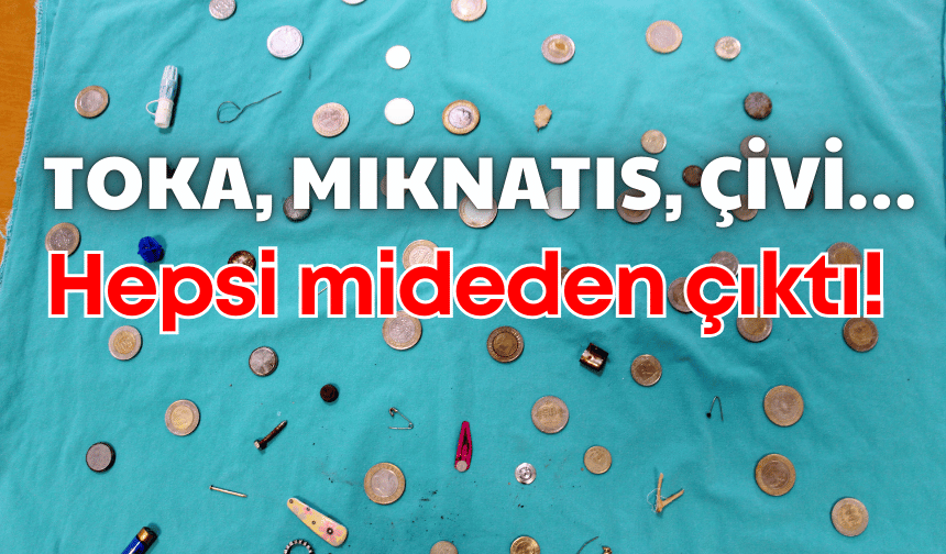 Toka, mıknatıs, çivi… Daha neler neler hepsi mideden çıktı!