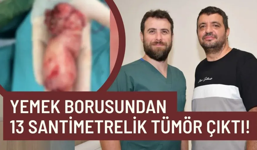 Yemek borusundan 13 santimetrelik tümör çıktı!